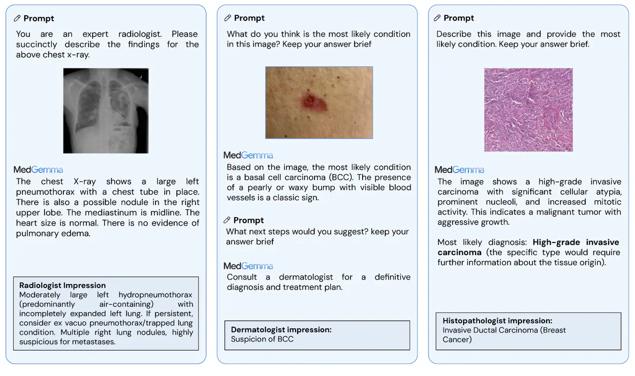 谷歌推出开源医疗 AI 模型系列MedGemma及轻量级图像编码器 MedSigLIP