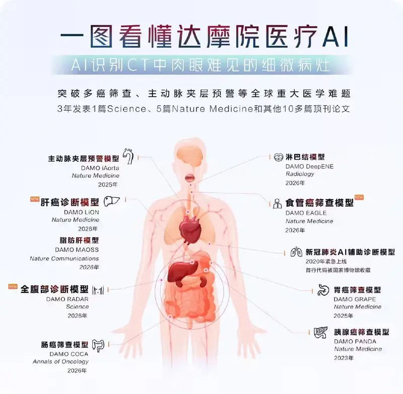 阿里达摩院发布食管癌筛查AI模型DAMO EAGLE，平扫CT即可识别早期病变，登上Nature Medicine